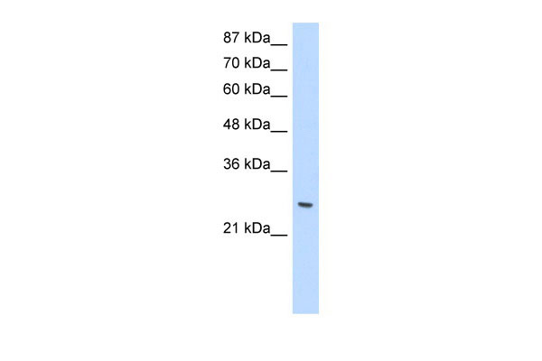 1 - ZNF575 antibody - C-terminal region AI11659