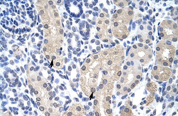 2 - APTX antibody - C-terminal region AI11660