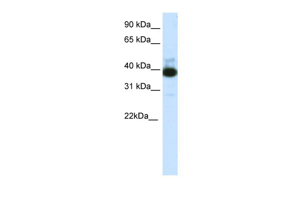 1 - TTC19 antibody - C-terminal region AI11682