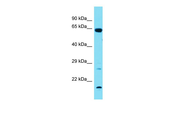 1 - Tbx18 Antibody - N-terminal region AI11683