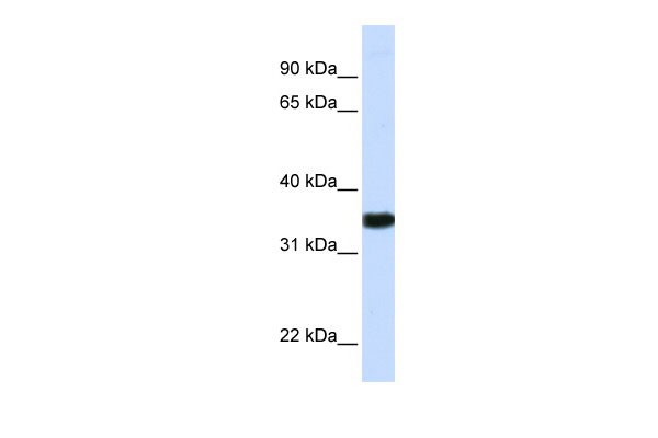 1 - GAPDH antibody - N-terminal region AI11693