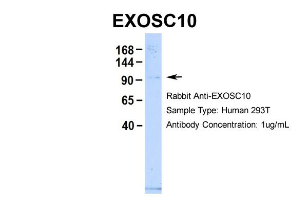 1 - EXOSC10 antibody C-terminal region AI11705