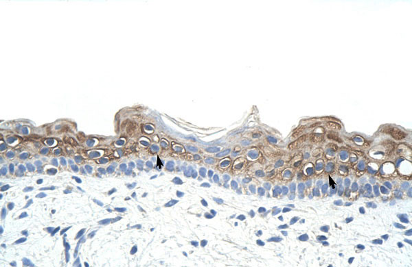 2 - DAZ2 antibody - N-terminal region AI11712