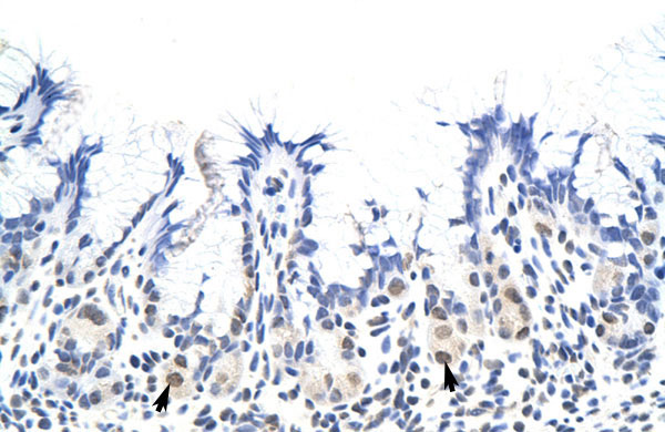 2 - RP11-78J21.1 antibody - N-terminal region AI11719
