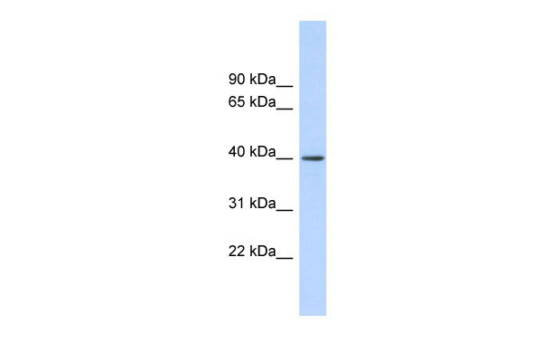 1 - RAD51AP1 antibody - middle region AI11779