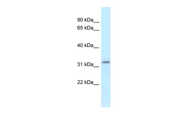 1 - Hsd17b11 antibody - middle region AI11803
