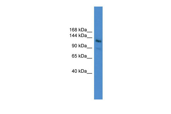 1 - LARP1 antibody - N-terminal region AI11842