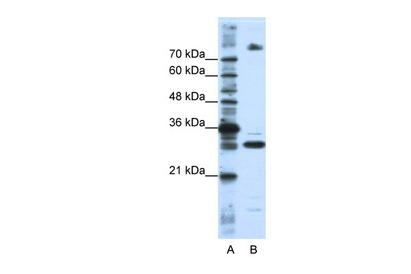 1 - FUSIP1 antibody - C-terminal region AI11843