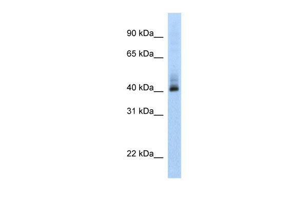 1 - ANKRD42 antibody - N-terminal region AI11856