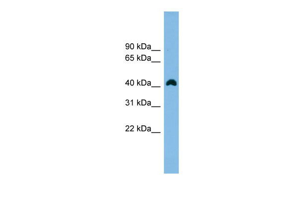 1 - ANKRD42 antibody - N-terminal region AI11857