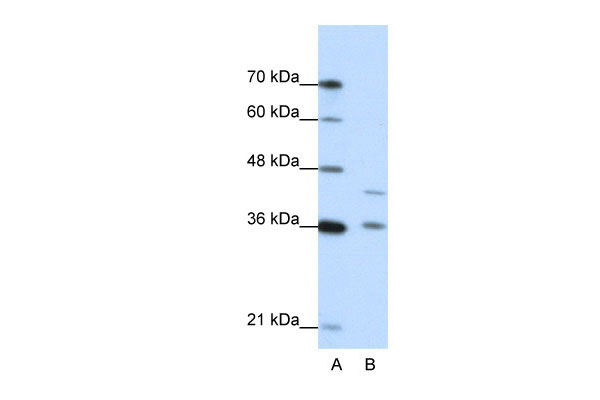 1 - NKD2 antibody - N-terminal region AI11870