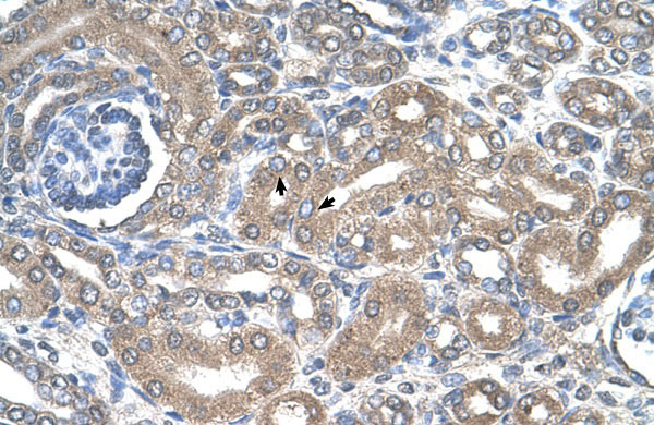 2 - SLC12A1 antibody - N-terminal region AI11886