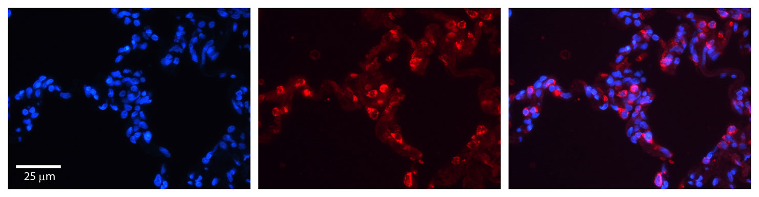 2 - SFTPB antibody - middle region AI11889