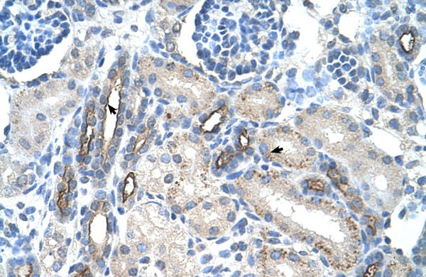 2 - MUC1 antibody - C-terminal region AI11896