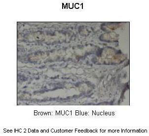 2 - MUC1 antibody - C-terminal region AI11896