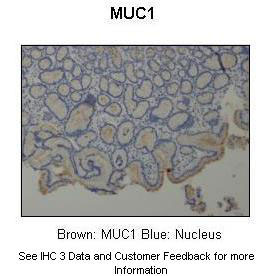 2 - MUC1 antibody - C-terminal region AI11896