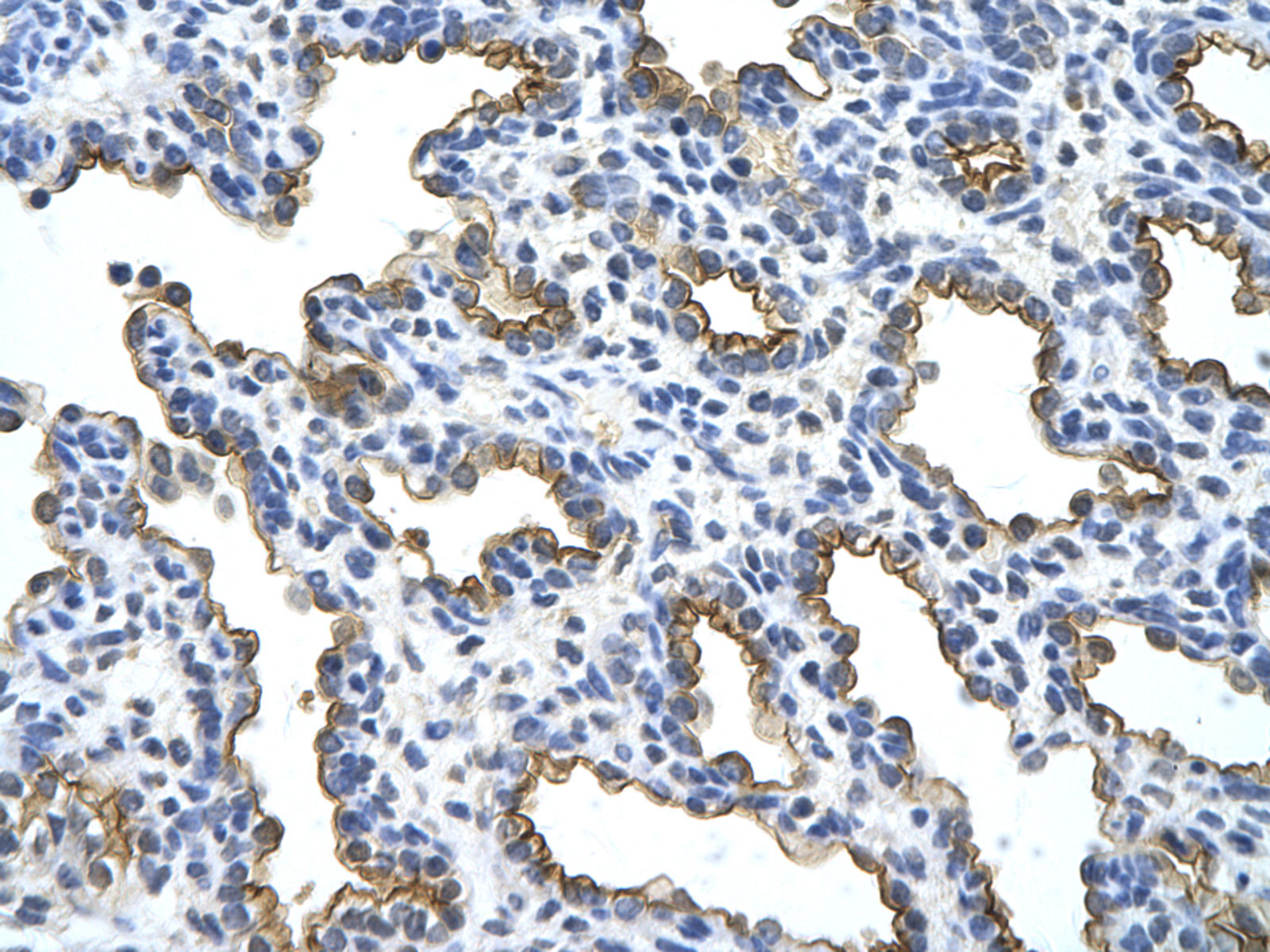 2 - MUC1 antibody - C-terminal region AI11896