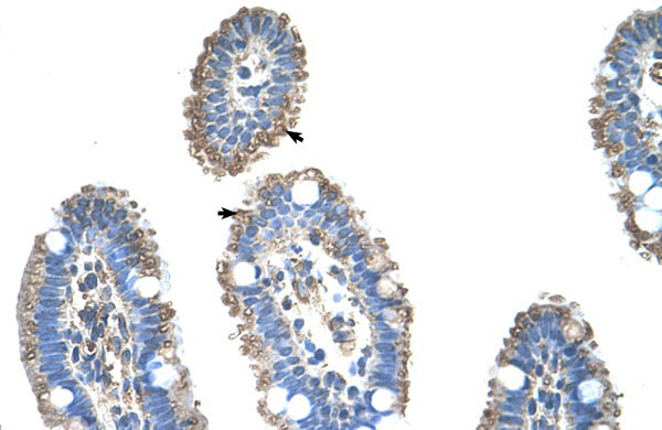 2 - SLC22A1 antibody - N-terminal region AI11904