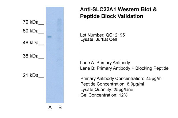 1 - SLC22A1 antibody - N-terminal region AI11904