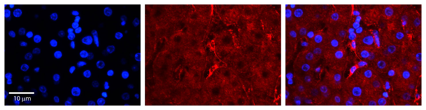 2 - LBP antibody - C-terminal region AI11907