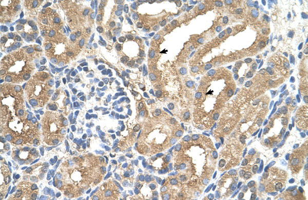 2 - ADAMTS4 antibody - N-terminal region AI11908