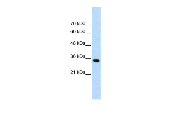 1 - ADAMTS4 antibody - N-terminal region AI11908