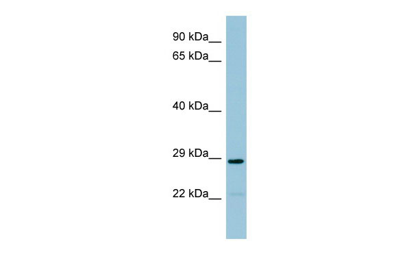1 - NAT8B antibody - middle region AI11915