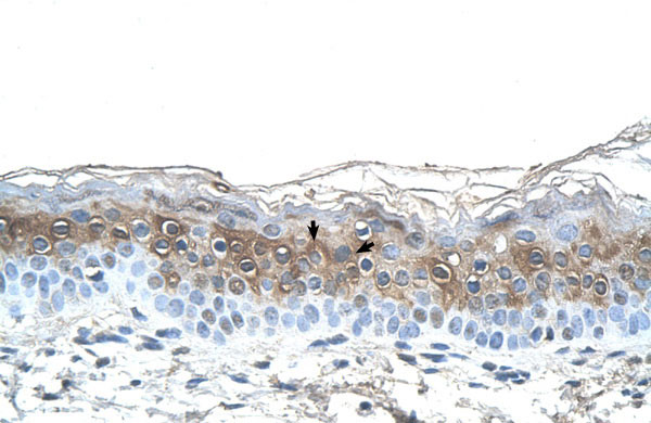 2 - FGA antibody - N-terminal region AI11937
