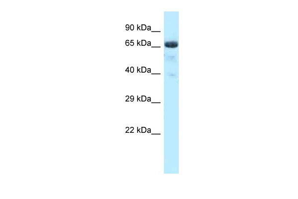 1 - Btrc antibody - N-terminal region AI11981