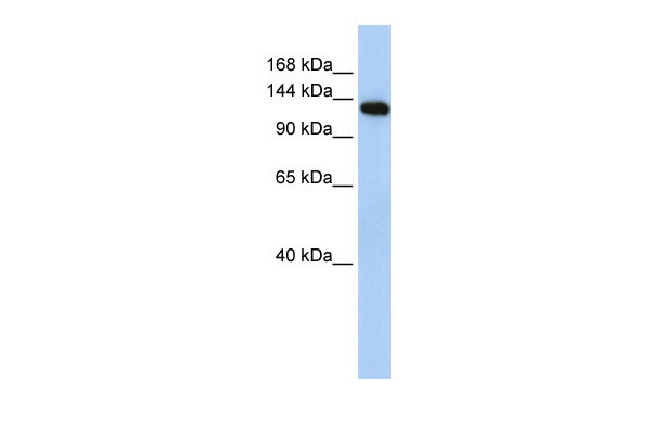 1 - MYBPC2 antibody - N-terminal region AI11985
