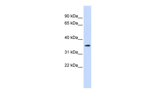 1 - GPR6 antibody - N-terminal region AI11990