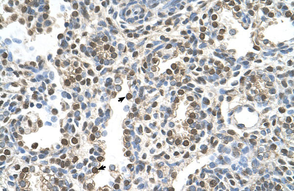 2 - MAGEA8 antibody - N-terminal region AI11991