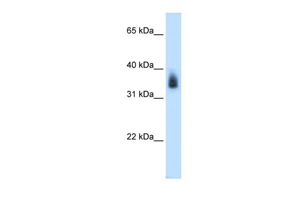 1 - MAGEA8 antibody - N-terminal region AI11991