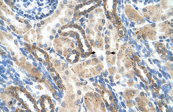 2 - PSG1 antibody - N-terminal region AI12001