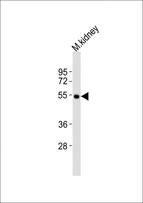 1 - Drd5 Antibody (N-term).ctrl AP21351a