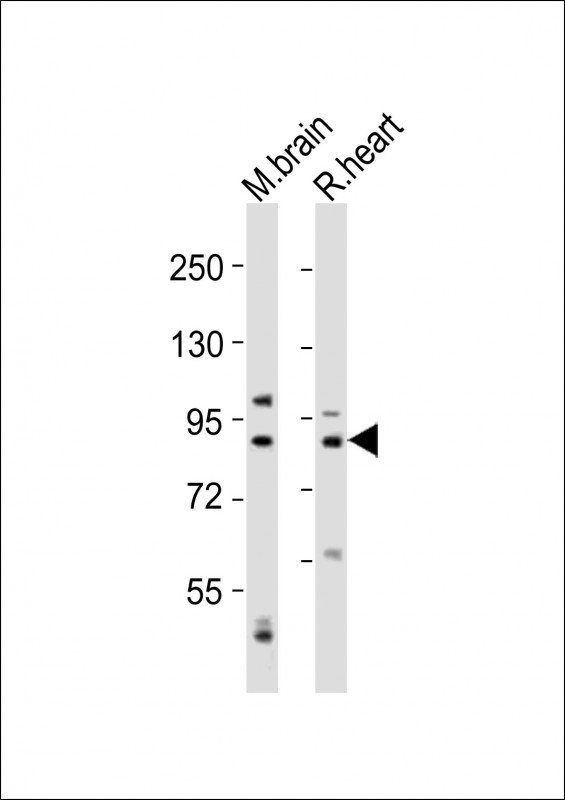1 - CAPN5 Antibody (N-Term) AP21389a