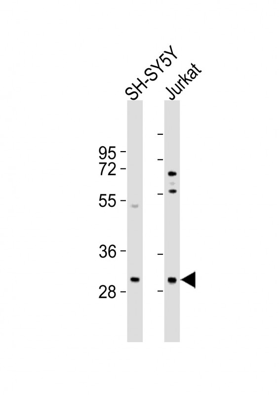 1 - TRMT61A Antibody (N-term) AP21425a