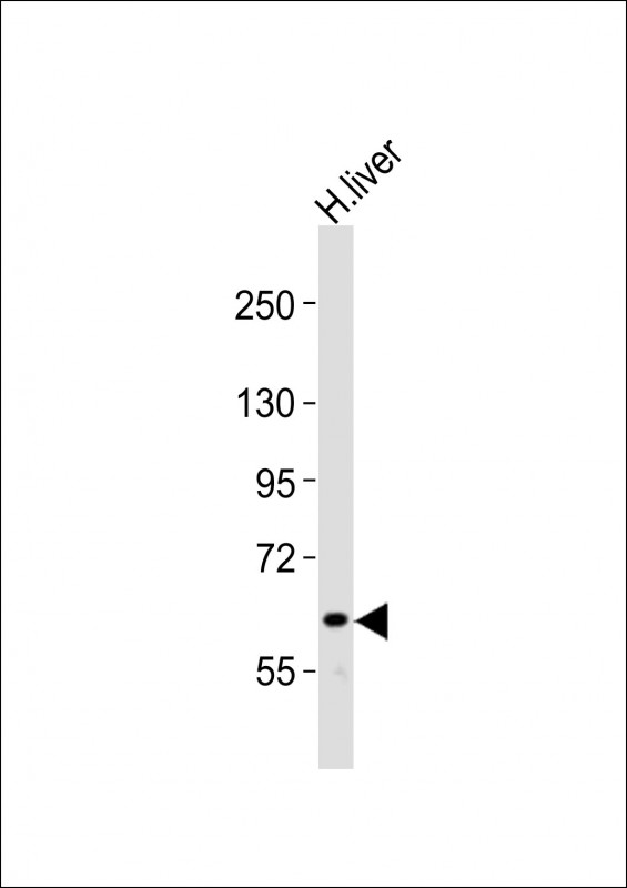 1 - NOTCH4 Antibody (C-term) AP21426b