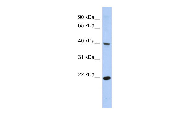 1 - SSBP4 antibody - middle region AI12032