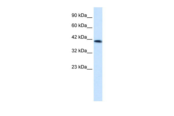 1 - ZNF670 antibody - N-terminal region AI12033