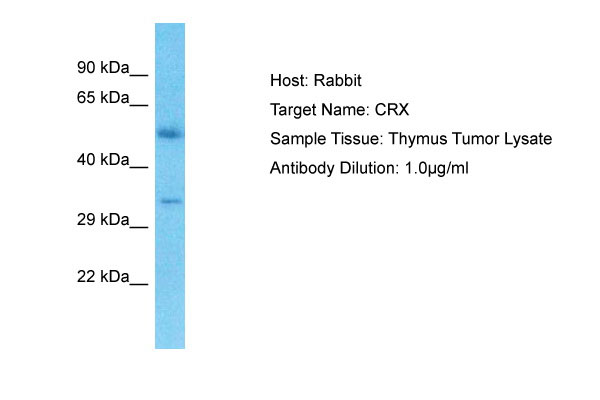 1 - CRX Antibody - N-terminal region AI12040
