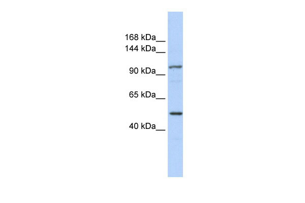 1 - KIAA1618 antibody - N-terminal region AI12041