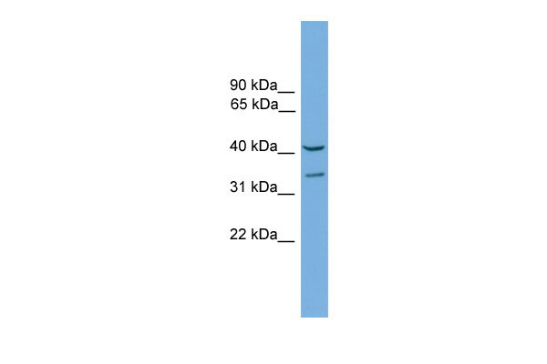 1 - Fkhl18 antibody - C-terminal region AI12048