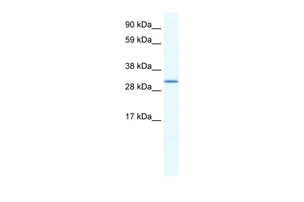 1 - SPIC antibody - N-terminal region AI12064
