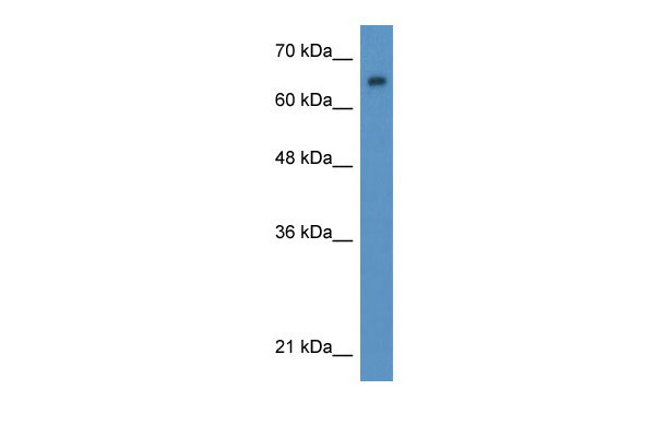 1 - WT1 antibody - N-terminal region AI12067