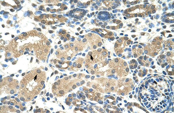 2 - DMRT2 antibody - N-terminal region AI12088