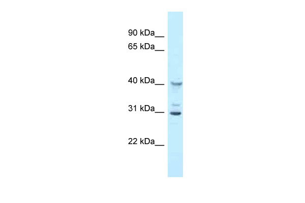 1 - Oas1g antibody - N-terminal region AI12092