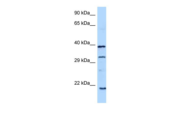 1 - GH1 antibody - C-terminal region AI12100