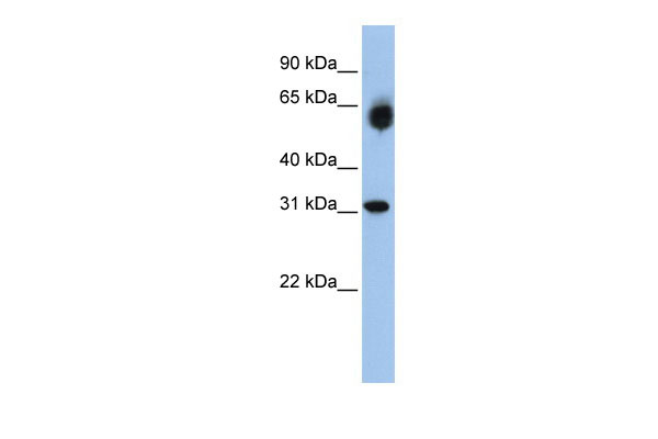 1 - DHRS2 antibody - middle region AI12102