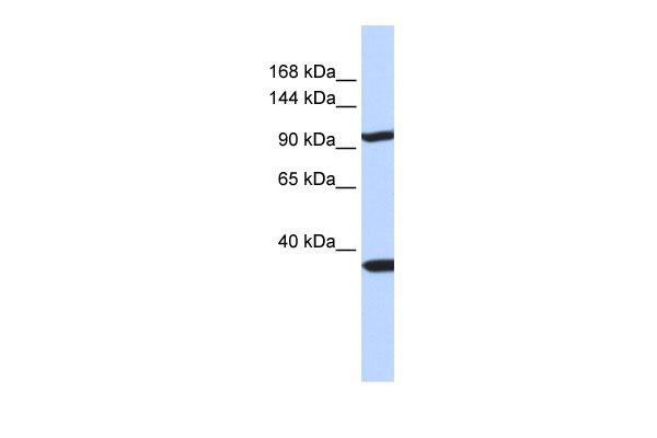 1 - PAPPA2 antibody - N-terminal region AI12114